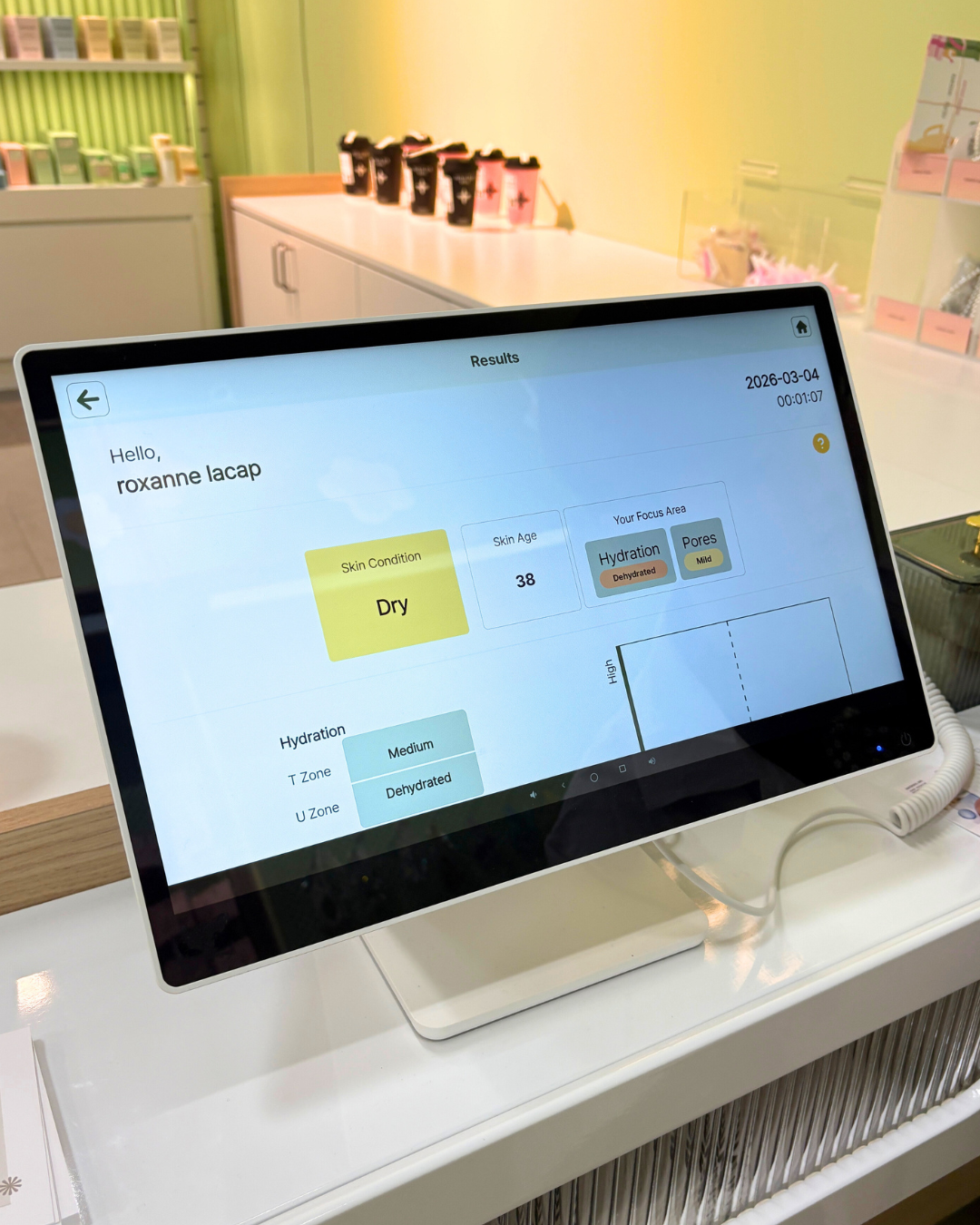 Skin analysis results screen showing dry skin condition dehydrated pores and skin age 38 at Sukoshi Mart Toronto