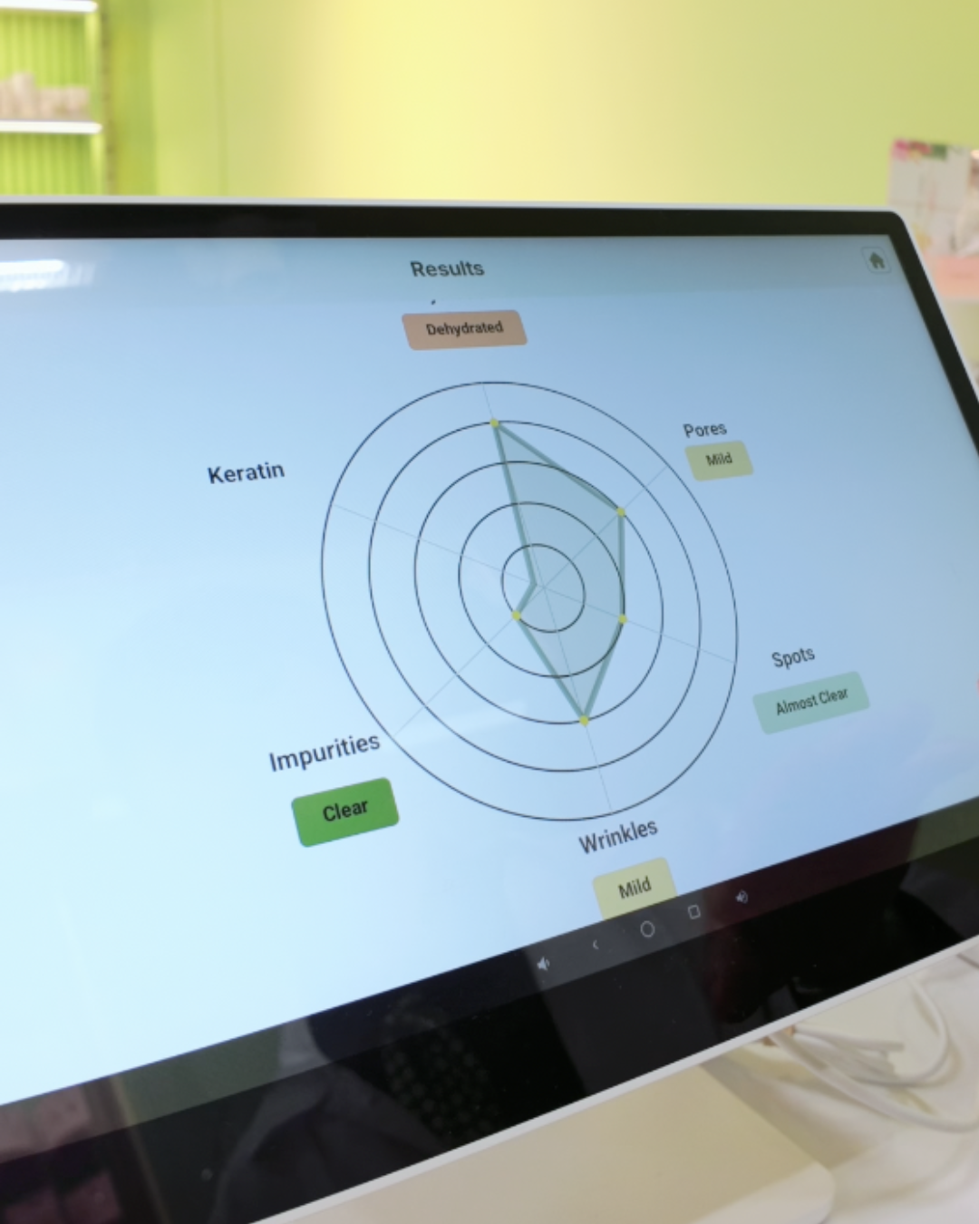 Skin analysis results radar chart showing dehydrated skin mild pores and almost clear spots at Sukoshi Mart